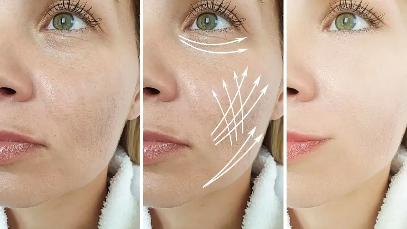 Can One Treatment Really Tackle More Than One Skin Concern Boston?