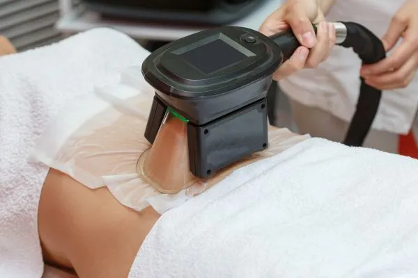 Image of person having fat freezing treatment to help weight gain Boston