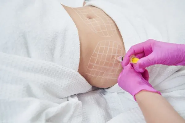 image of fat dissolving injections on love handles to help combat weight gain Boston