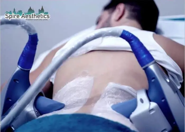 Man having fat freezing treatment done on love handles before a competitions Boston to create a sculpted look.