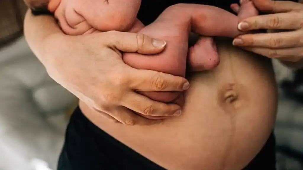 Why Is My Stomach Still Big After Pregnancy Boston?