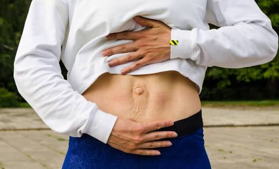 When Could Diastasis Recti Be the Missing Piece of the Puzzle Boston?